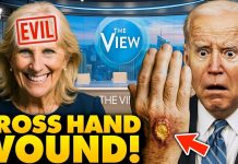 Audience Shocked By Mysterious WOUND on Biden’s Hand Before Joe Collapses on LIVE TV | Jill Screams